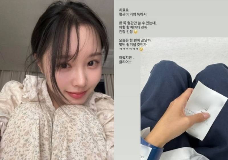 대표 이미지