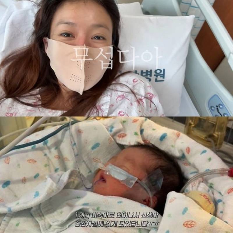 이시영, 미숙아 출산 후 응급수술… 병원비 890만 원