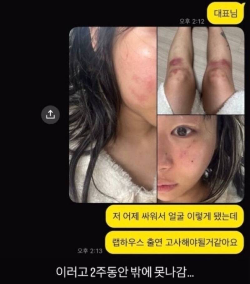 대표 이미지