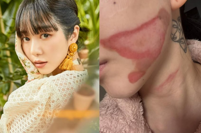 대표 이미지