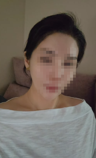 주사이모 A씨 SNS 근황 관련 보도 이미지