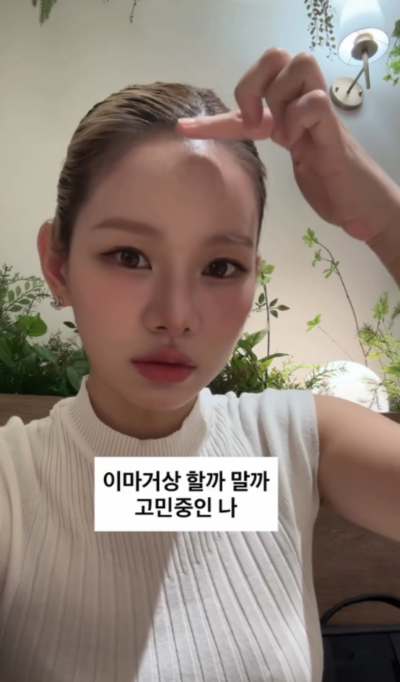 맹승지, 성형 원상복구 후 또 고민...이번엔 이마거상 [IS하이컷]
